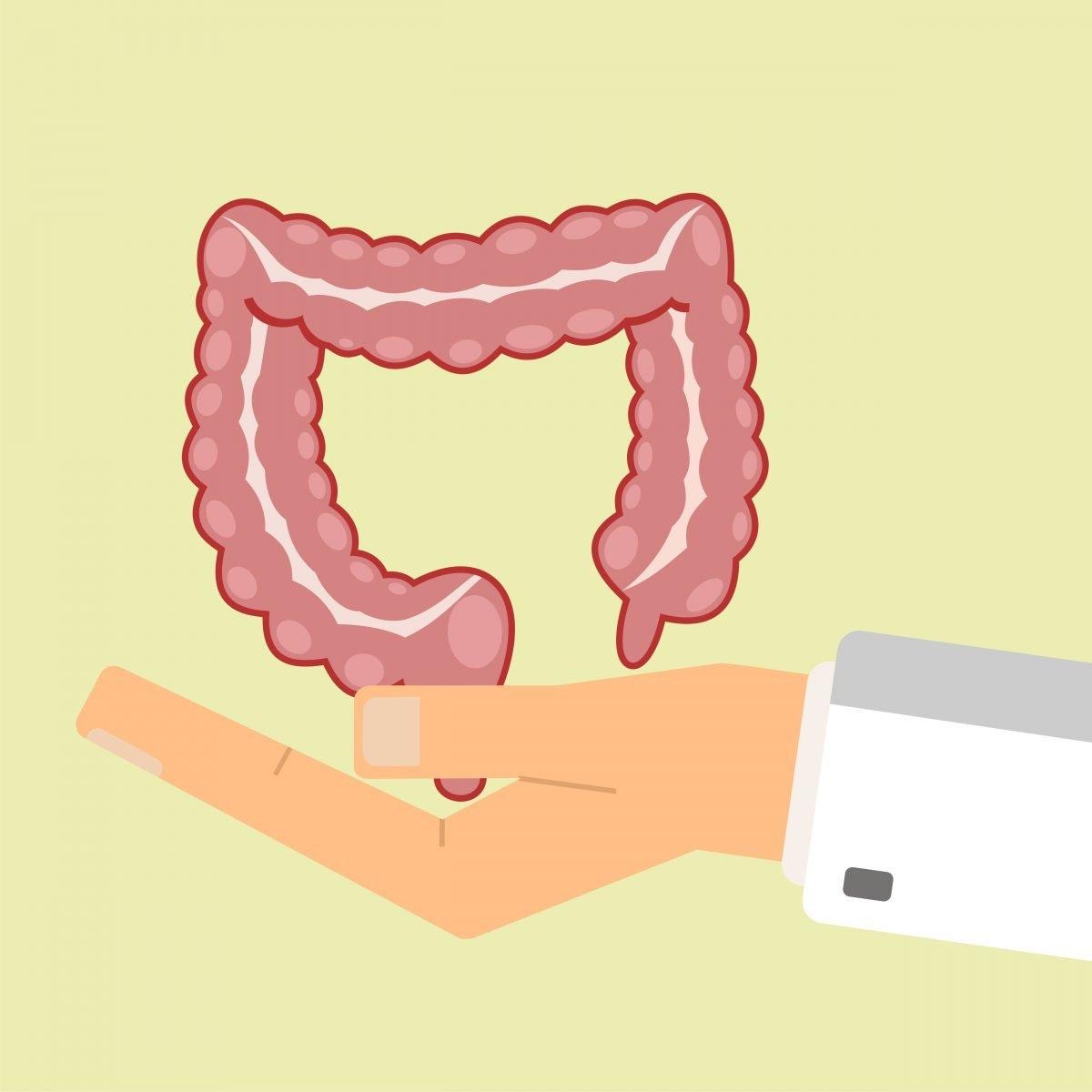 Câncer de Intestino: Tudo o que você precisa saber sobre