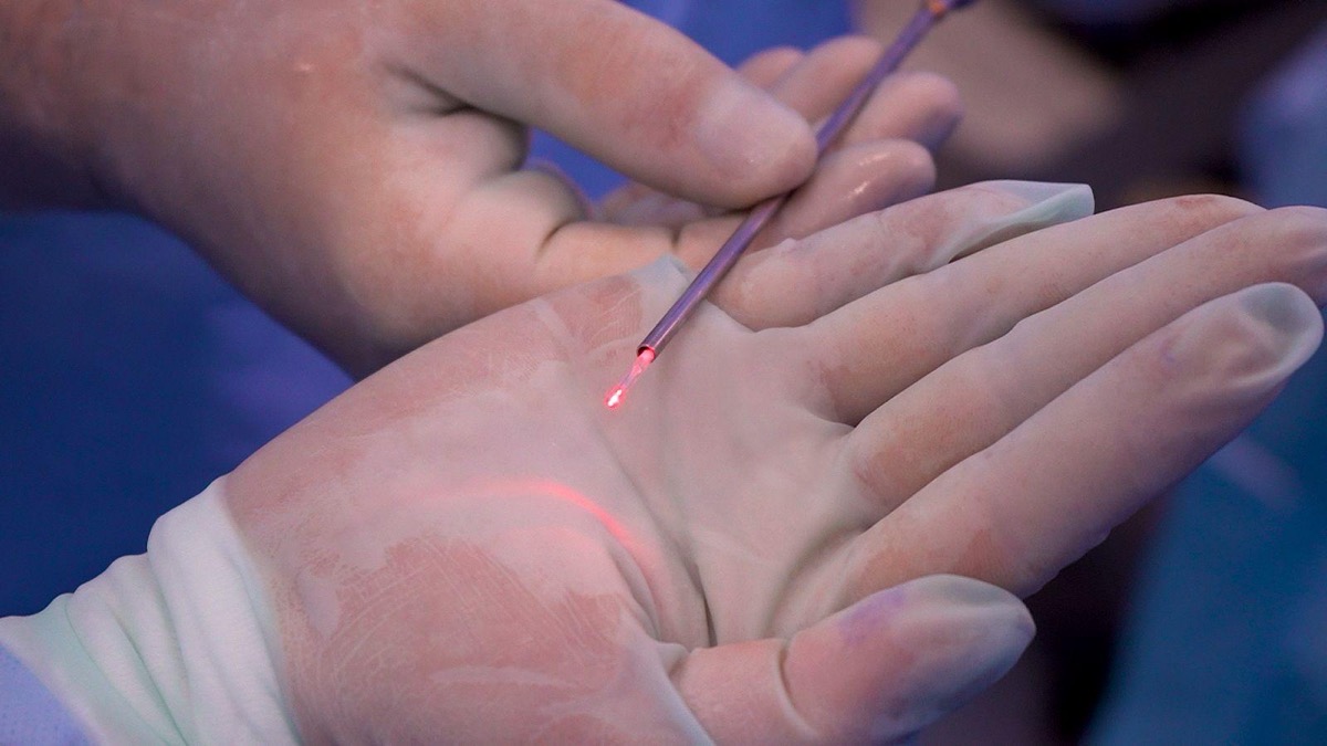 Terapia com laser: o que é?