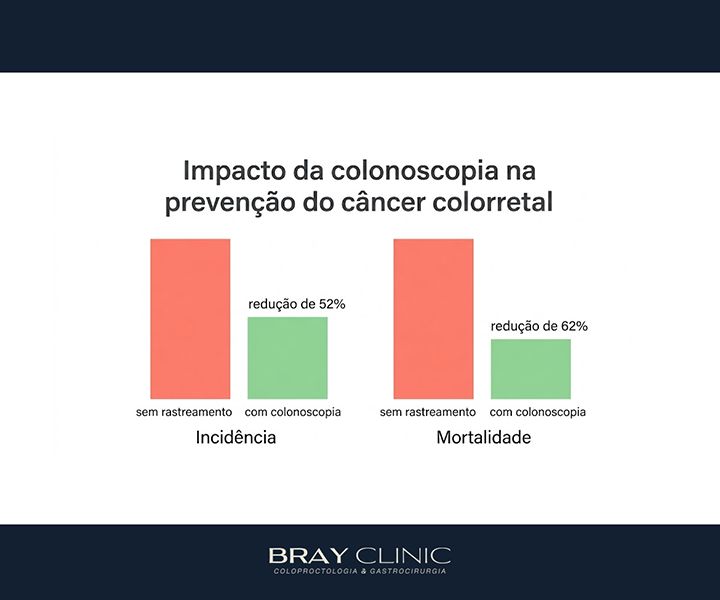 Colonoscopia sem medo: o que você precisa saber para parar de adiar