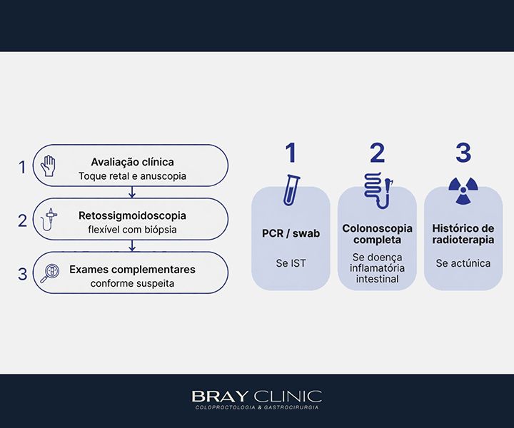 Proctite: o que é, quais as causas e como é feito o tratamento