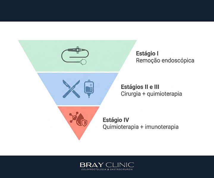 Como identificar os sinais do câncer de estômago e quando buscar ajuda