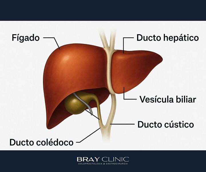 Colecistite aguda: entenda a inflamação da vesícula e saiba quando buscar ajuda