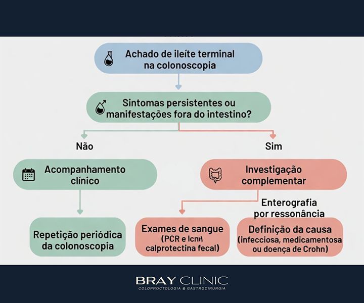 Ileíte: entenda a inflamação do íleo e saiba o que fazer após o diagnóstico