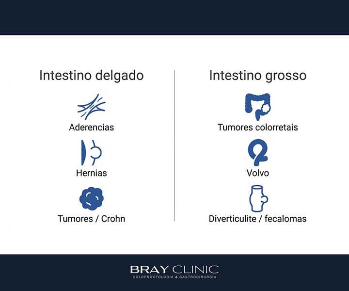 Obstrução intestinal: o que causa, quais os sintomas e como é o tratamento