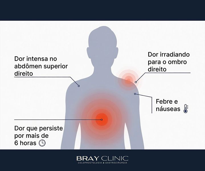 Colecistite aguda: entenda a inflamação da vesícula e saiba quando buscar ajuda
