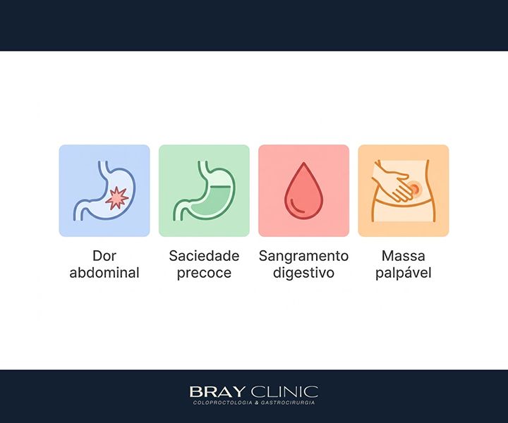O que é GIST e como esse tumor é diagnosticado e tratado