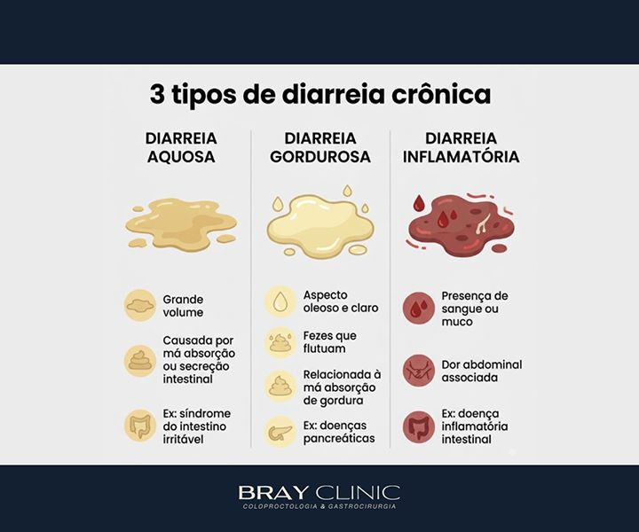 Diarreia crônica: por que o sintoma persiste e como investigar a causa