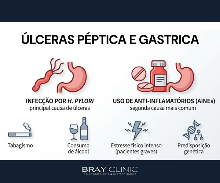Úlcera gástrica: entenda as causas, os riscos e o caminho para o tratamento